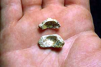 Hioides Atapuerca