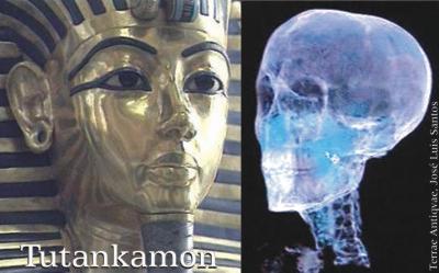 Tutankamon no fue asesinado. Resultados del TAC
